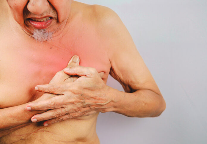 senior man is clutching he chest. possible heart attack